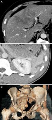 Hematocrit and lactate trends help predict outcomes in trauma independent of CT and other clinical parameters